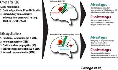 Stimulation Mapping Using Stereoelectroencephalography: Current and Future Directions